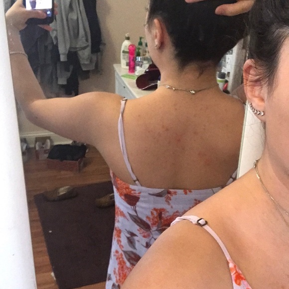 ❤️SUMMER DRESS🤩 - Picture 5 of 8